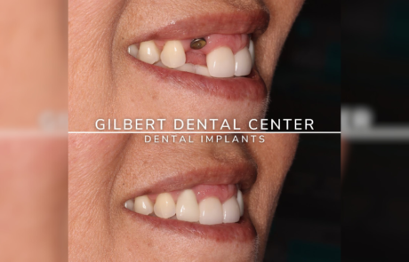 Spend It In Gilbert AZ Gilbert Dental Center 6